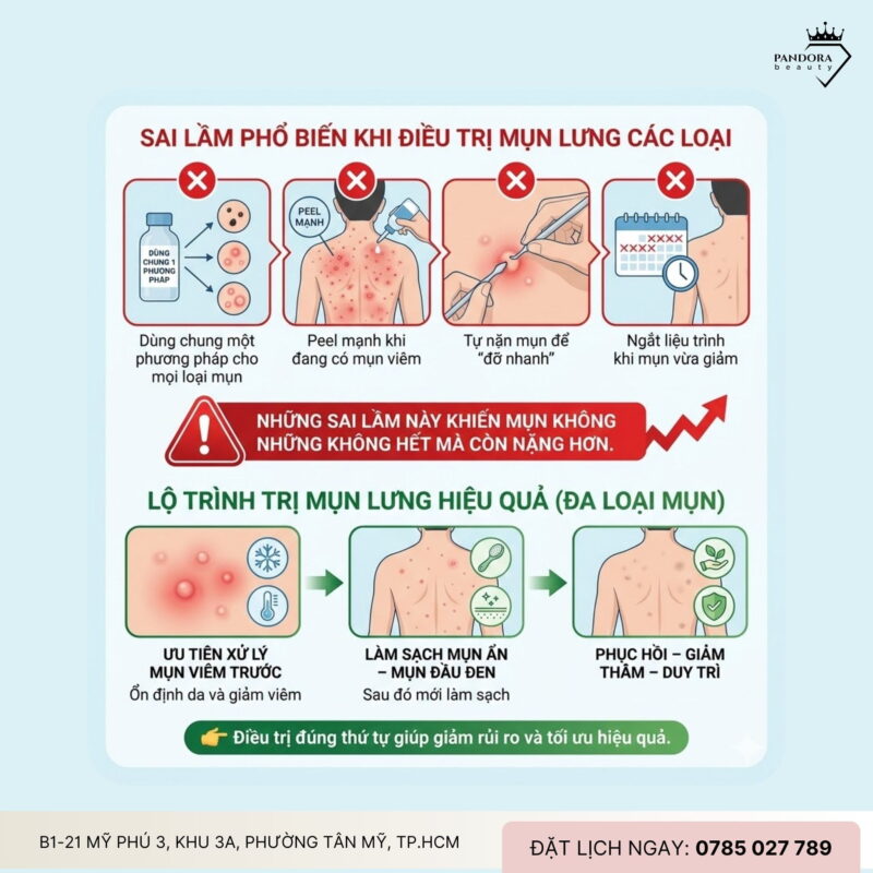 Phân biệt và điều trị mụn lưng các loại: Hiểu đúng mụn – trị mụn lưng mới hiệu quả