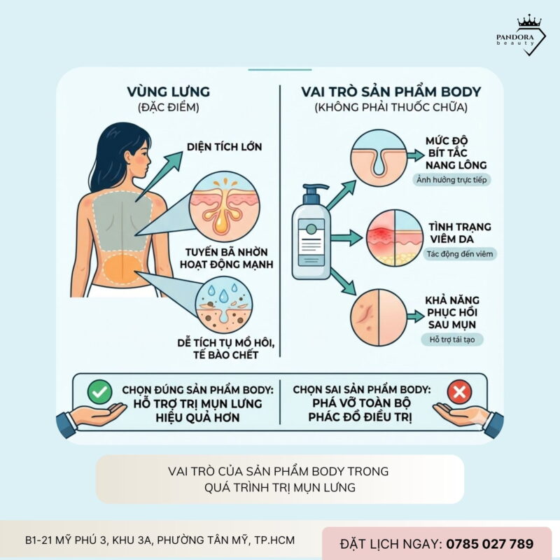 Trị mụn lưng: Cách chọn sản phẩm body hỗ trợ điều trị hiệu quả và an toàn