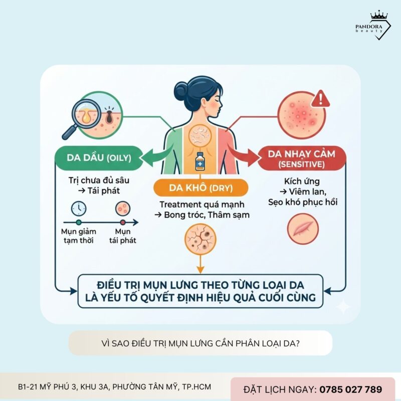 Điều trị mụn lưng theo da dầu – da khô – da nhạy cảm: Cá nhân hóa đúng mới hết mụn bền vững