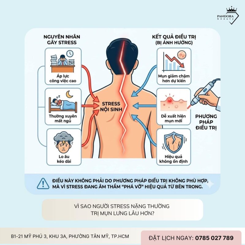 Trị mụn lưng và stress: Vì sao càng căng thẳng, mụn càng lâu khỏi?