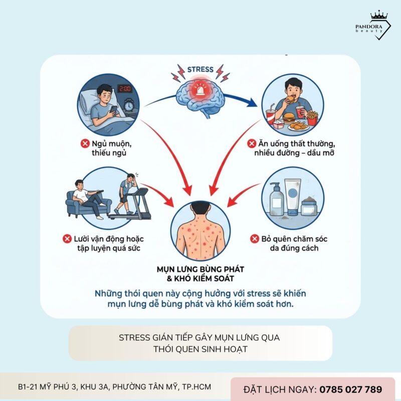 Trị mụn lưng và stress: Vì sao càng căng thẳng, mụn càng lâu khỏi?