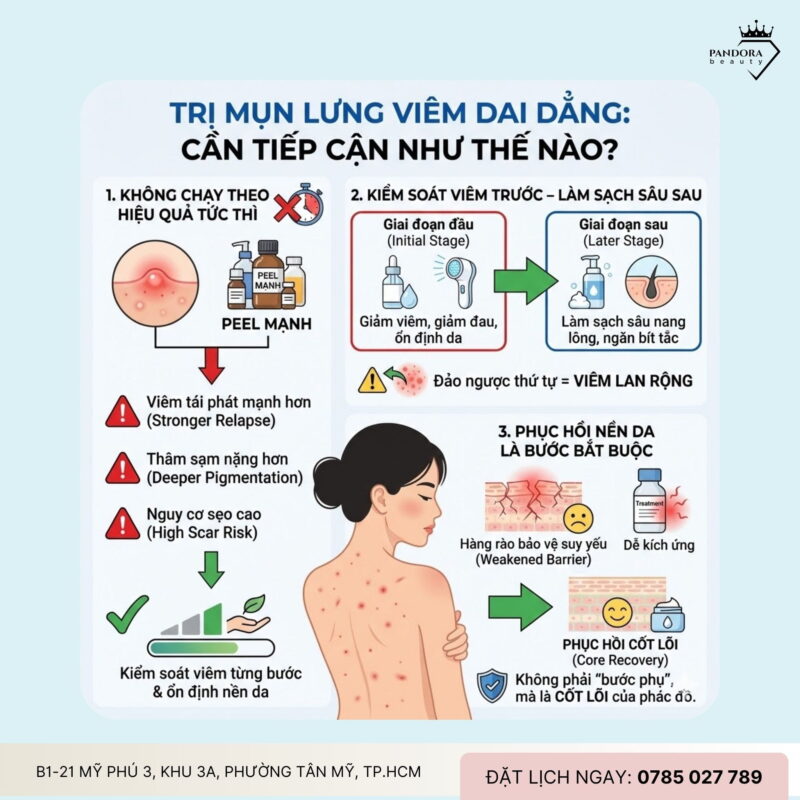 Trị mụn lưng viêm dai dẳng: Vì sao khó dứt điểm và đâu là hướng điều trị đúng?