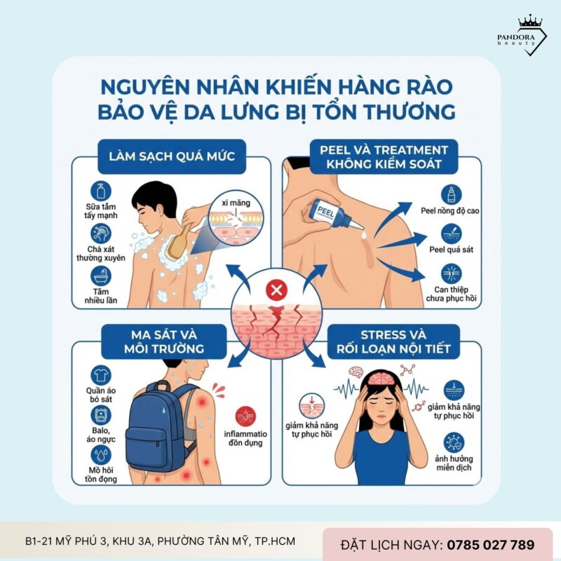 Trị mụn lưng - Hàng rào bảo vệ da lưng: Nền tảng quyết định hiệu quả lâu dài
