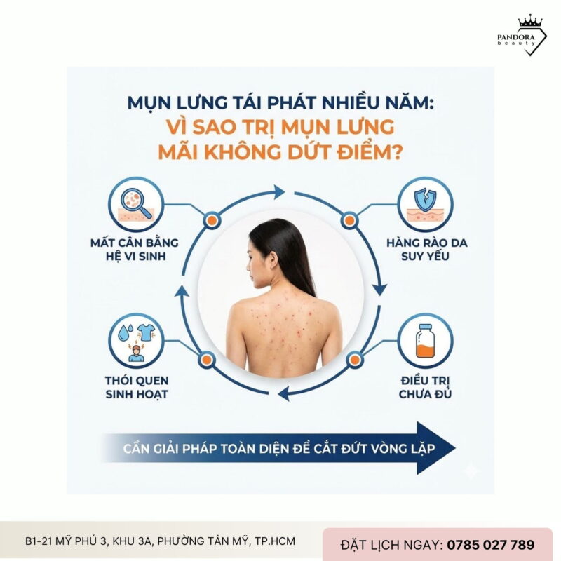 Mụn lưng tái phát nhiều năm: Vì sao trị mụn lưng mãi không dứt điểm?