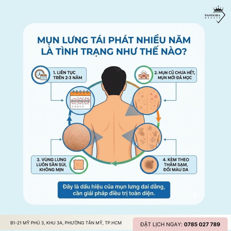 Mụn lưng tái phát nhiều năm: Vì sao trị mụn lưng mãi không dứt điểm?