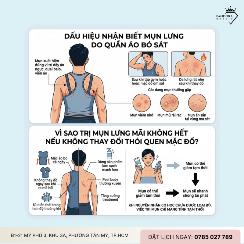 Mụn lưng do quần áo bó sát: Trị mụn lưng thế nào khi nguyên nhân đến từ thói quen mặc đồ?