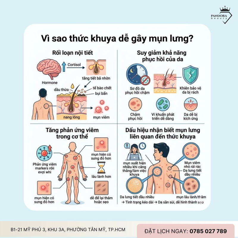 Trị mụn lưng do thức khuya: Vì sao thiếu ngủ khiến mụn lưng kéo dài?