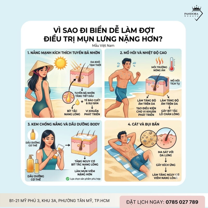 Trị mụn lưng khi đi biển: Làm sao để kiểm soát mụn lưng trong kỳ nghỉ?