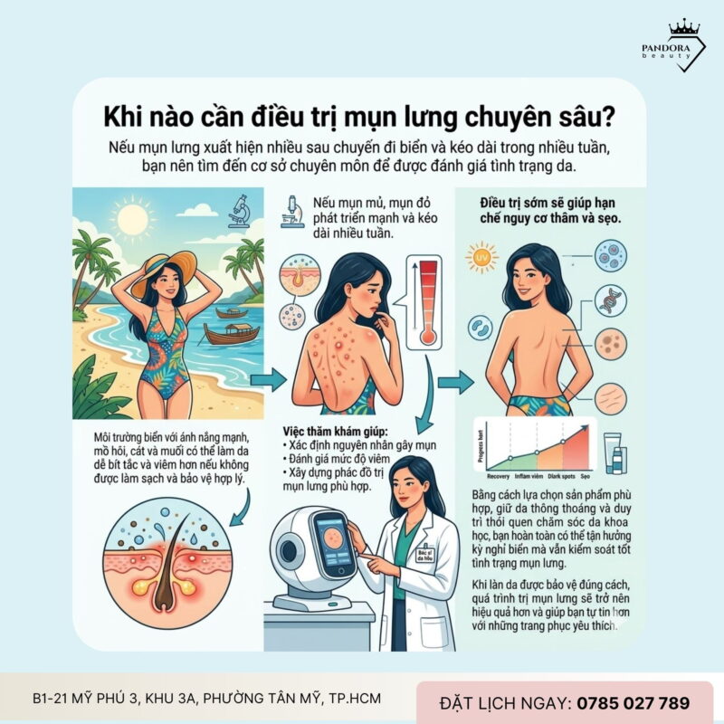 Trị mụn lưng khi đi biển: Làm sao để kiểm soát mụn lưng trong kỳ nghỉ?
