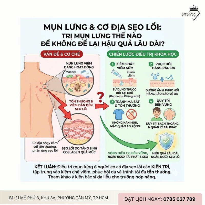 Mụn lưng & cơ địa sẹo lồi: Trị mụn lưng thế nào để không để lại hậu quả lâu dài?