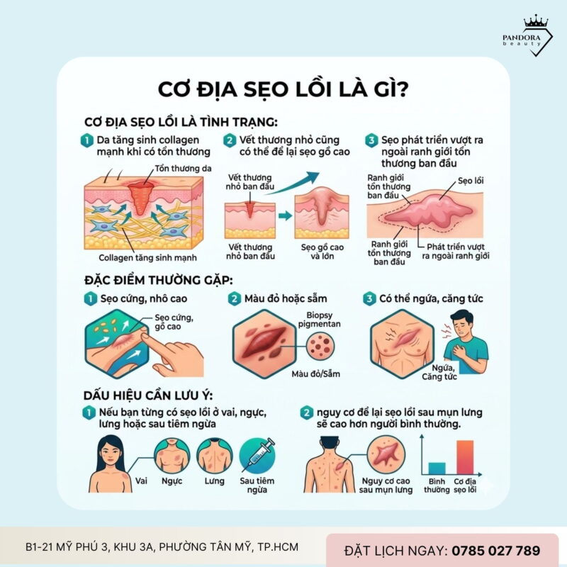 Mụn lưng & cơ địa sẹo lồi: Trị mụn lưng thế nào để không để lại hậu quả lâu dài?