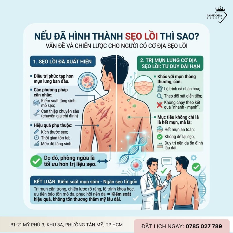 Mụn lưng & cơ địa sẹo lồi: Trị mụn lưng thế nào để không để lại hậu quả lâu dài?