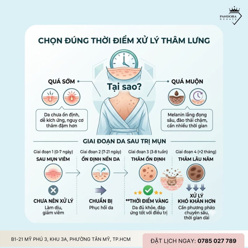 Trị mụn lưng & thời điểm “vàng” xử lý thâm sau mụn: Hiểu đúng để tối ưu hiệu quả điều trị