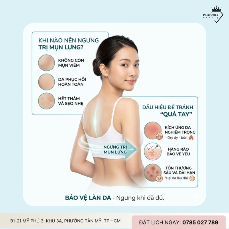 Khi nào nên ngưng trị mụn lưng? Dấu hiệu nhận biết để tránh “quá tay” và bảo vệ làn da