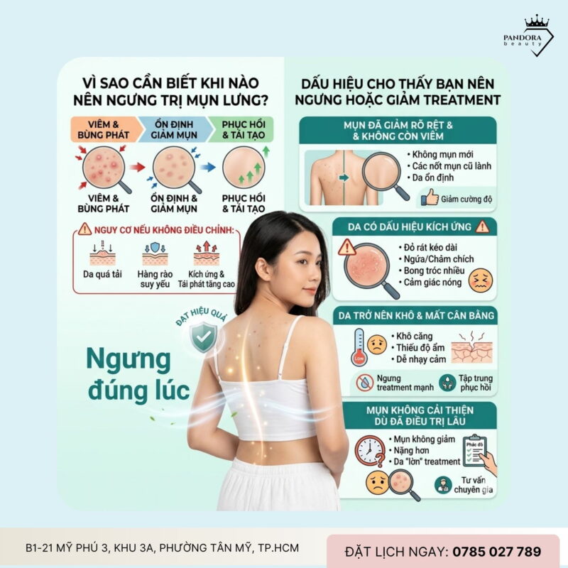 Khi nào nên ngưng trị mụn lưng? Dấu hiệu nhận biết để tránh “quá tay” và bảo vệ làn da