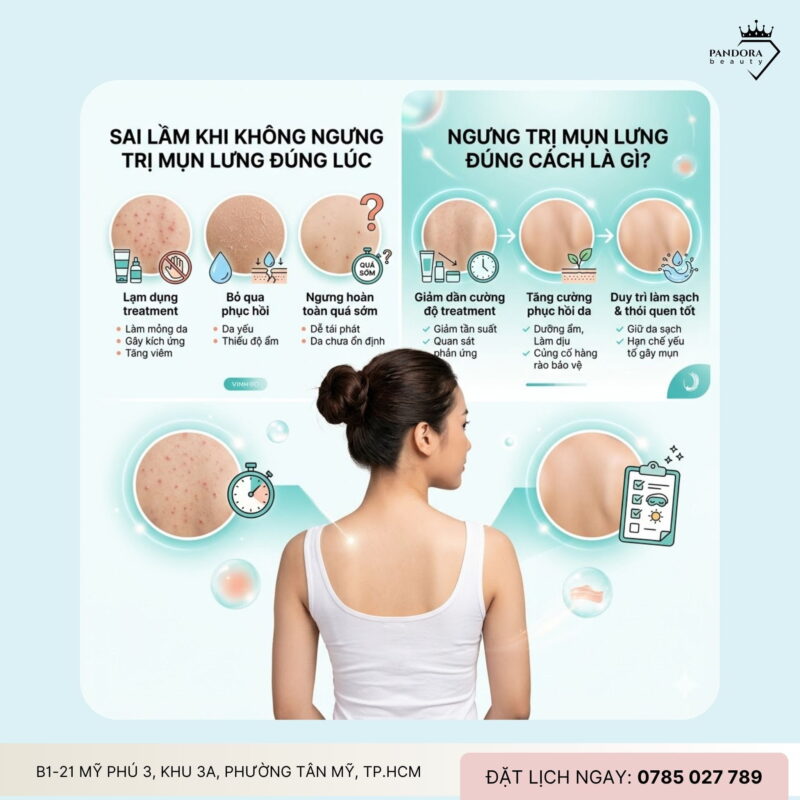 Khi nào nên ngưng trị mụn lưng? Dấu hiệu nhận biết để tránh “quá tay” và bảo vệ làn da