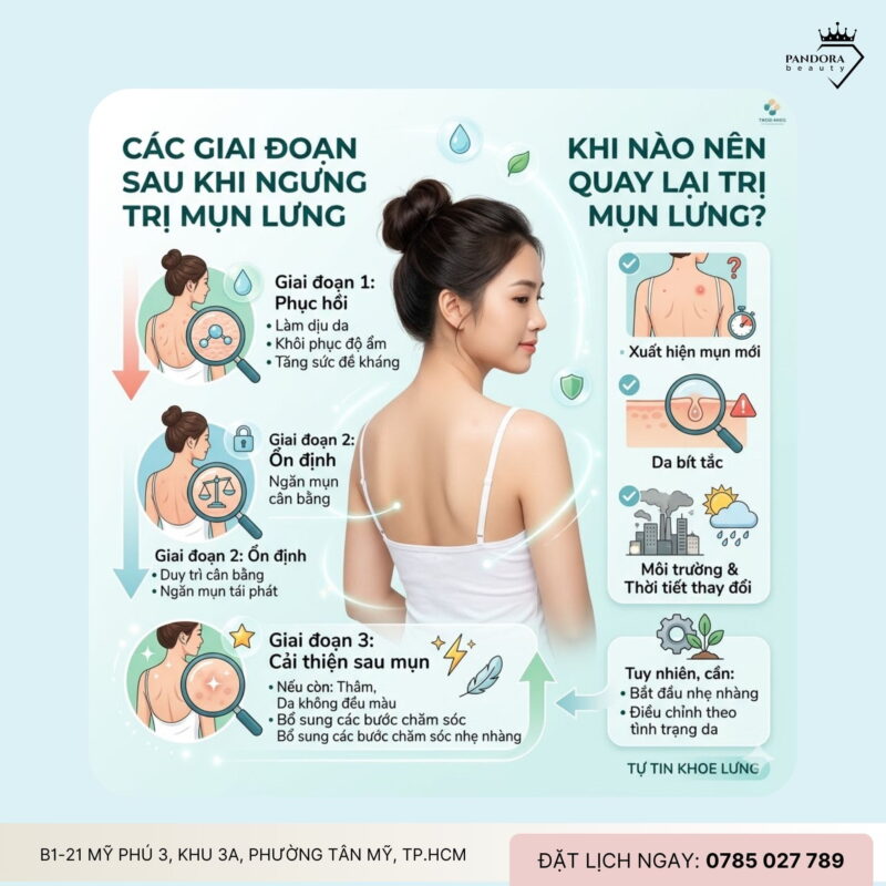 Khi nào nên ngưng trị mụn lưng? Dấu hiệu nhận biết để tránh “quá tay” và bảo vệ làn da