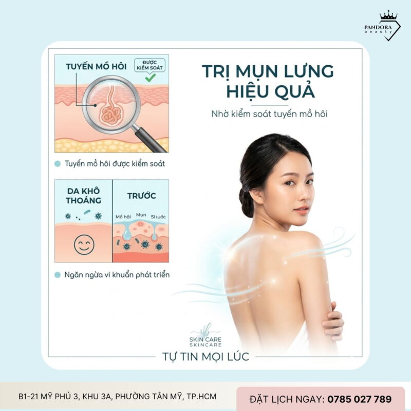 Trị mụn lưng hiệu quả nhờ kiểm soát tuyến mồ hôi: Giải pháp cốt lõi cho da sạch thoáng, ít tái phát