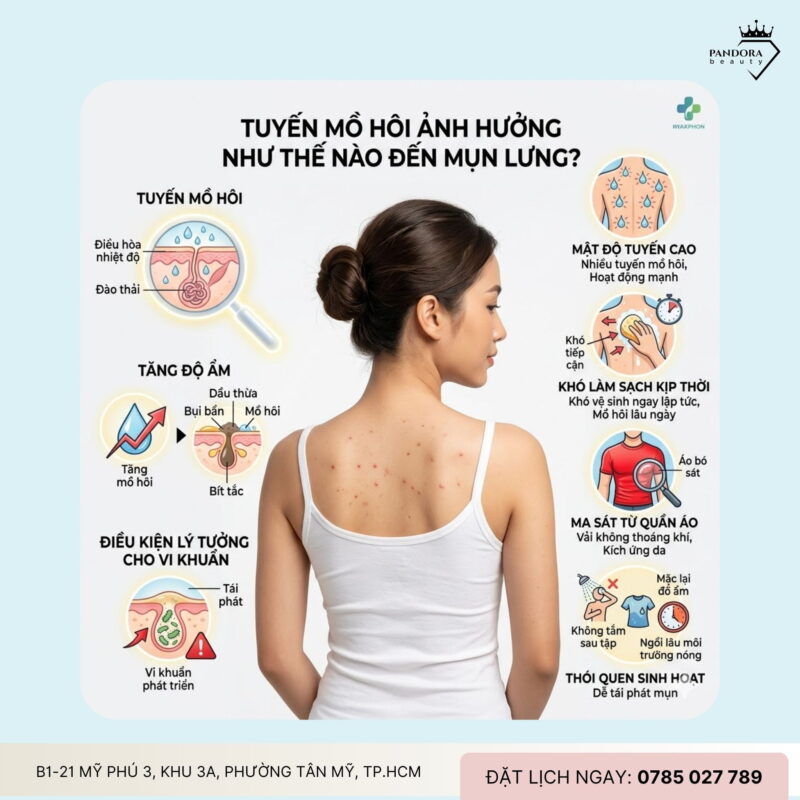 Trị mụn lưng hiệu quả nhờ kiểm soát tuyến mồ hôi: Giải pháp cốt lõi cho da sạch thoáng, ít tái phát