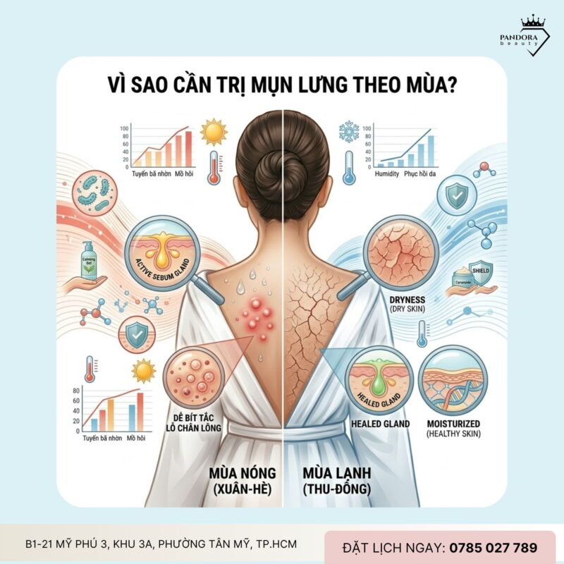 Trị mụn lưng theo mùa: Cá nhân hóa chăm sóc để kiểm soát mụn hiệu quả quanh năm