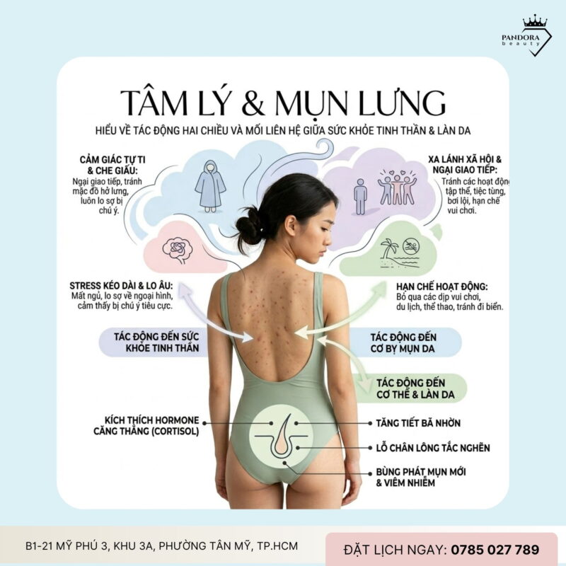 Trị mụn lưng & tâm lý: Khi làn da không chỉ là vấn đề bề mặt