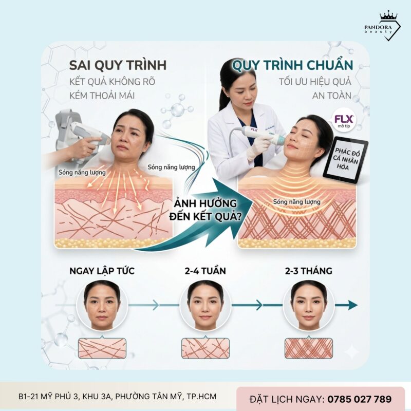 Trẻ hóa Thermage FLX – Quy trình chuẩn y khoa diễn ra như thế nào?