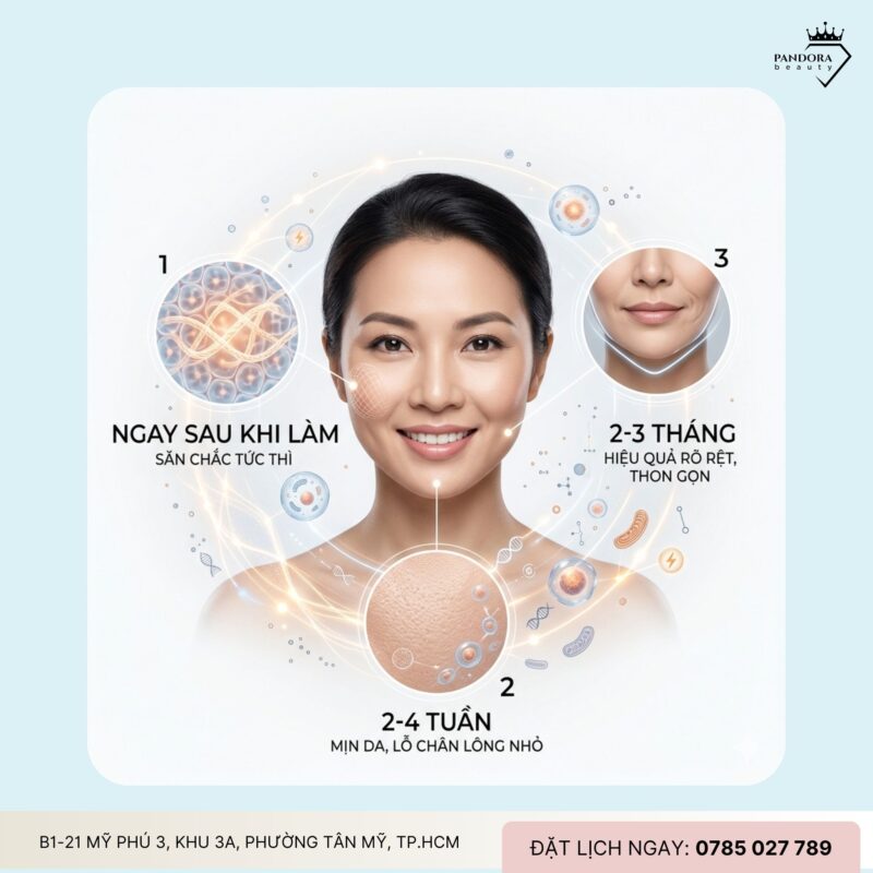 Review Trẻ hóa Thermage FLX – Khách hàng nói gì sau 1 lần làm?