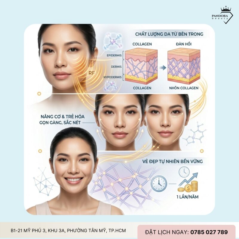 Trẻ hóa Thermage FLX toàn mặt – Có đáng để đầu tư?