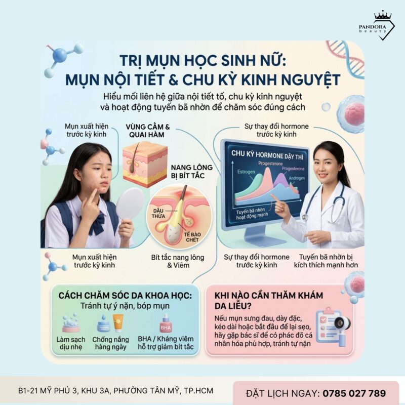 Trị mụn học sinh nữ: Mụn liên quan đến nội tiết và chu kỳ kinh nguyệt